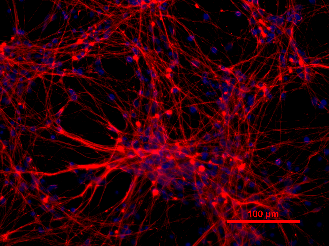 Red and blue neurons