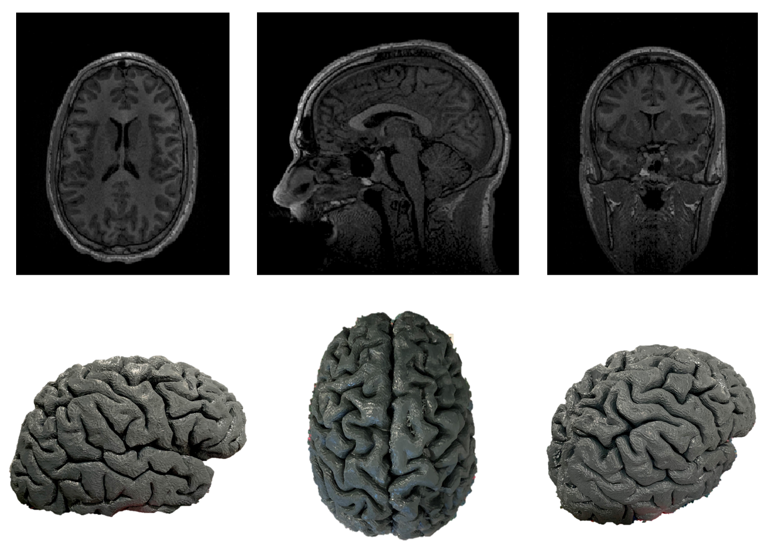 Brain Model Slices